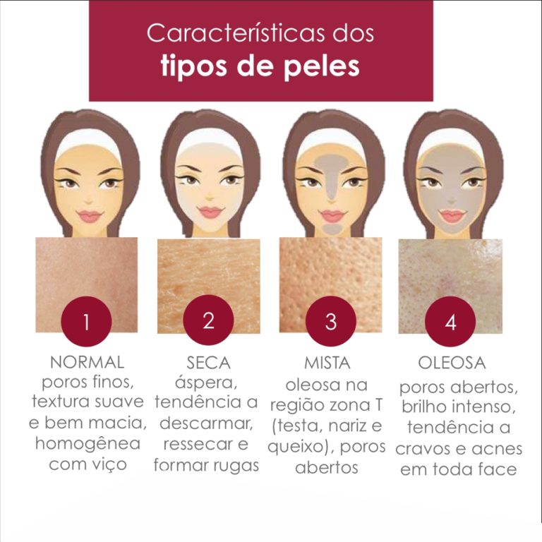 caracteristicas tipos de pele - Dra. Priscila Cartaxo Dermatologista em ...