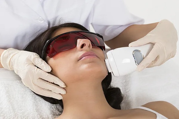 Laser Etherea MX: revolucionando a estética e saúde da pele!