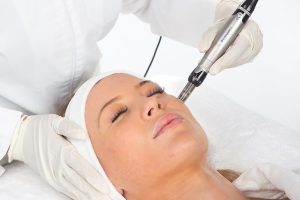 Microagulhamento (IPCA®): A técnica que está mudando o cuidado com a pele!