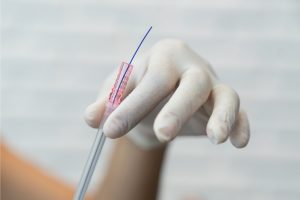 Inovação estética: explorando o impacto dos Fios de PDO no rejuvenescimento!
