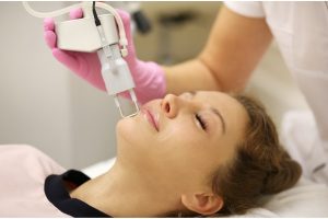 Descubra os benefícios do Laser Erbium Collagen para sua pele!