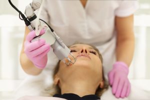 Laser Etherea MX: revolucionando o rejuvenescimento e a estética com tecnologia de ponta