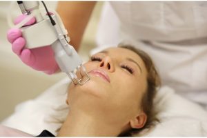 Laser Acroma: uma abordagem inovadora para o Melasma