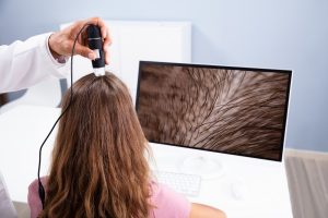 Tratamento Capilar iGrow: uma solução inovadora para a saúde capilar