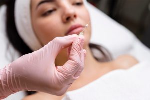 Fios de PDO: rejuvenescimento facial com segurança e praticidade